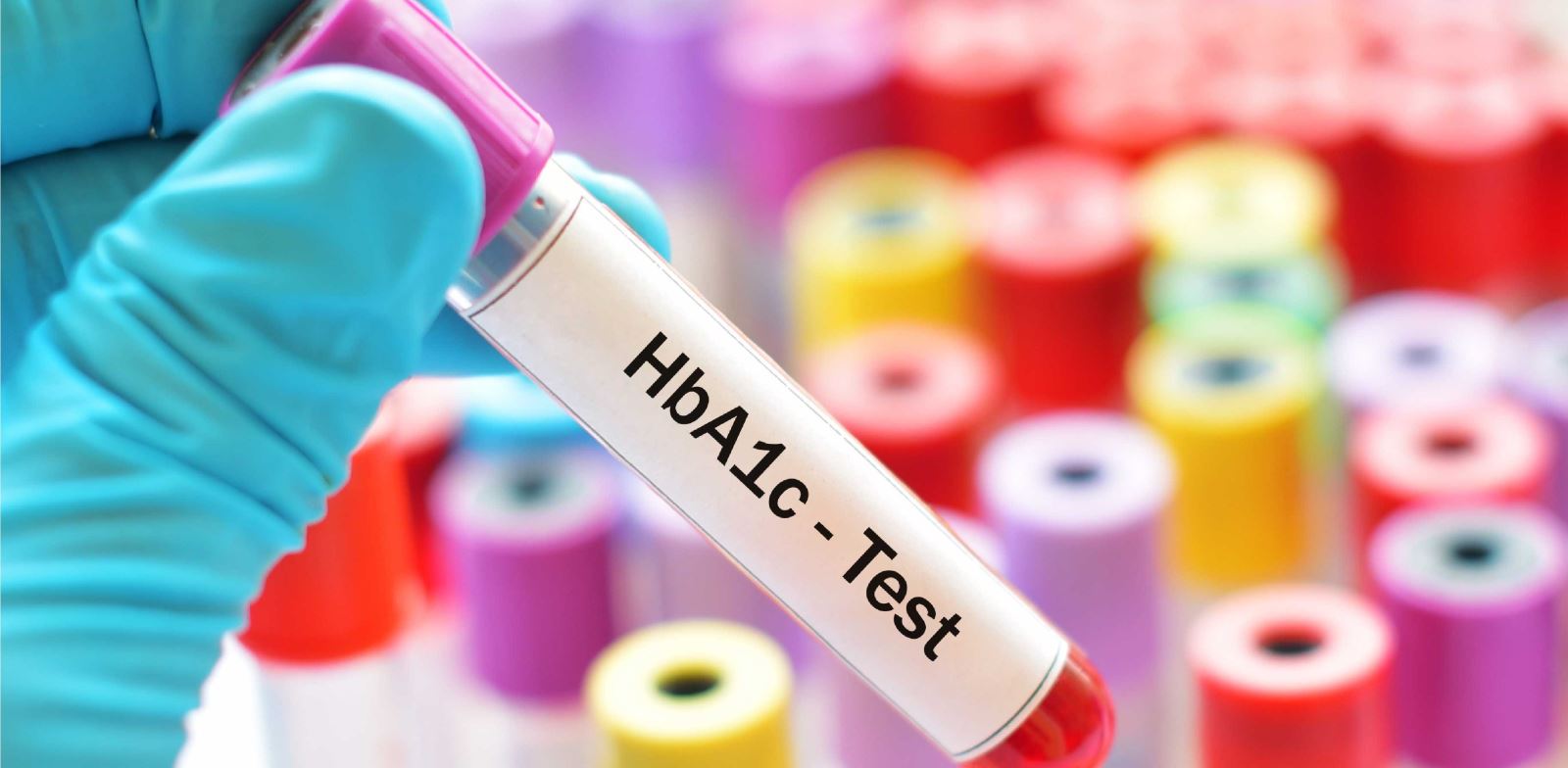 Hemoglobin A1c (HbA1c) Testi