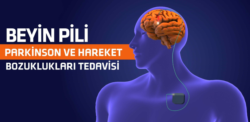 Beyin Pili: Parkinson ve Hareket Bozuklukları Tedavisi