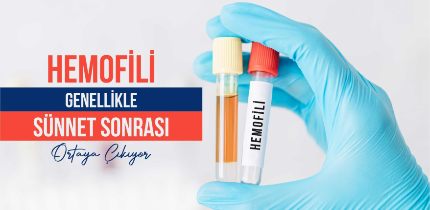 Hemofili Genellikle Sünnet Sonrası Ortaya Çıkıyor 