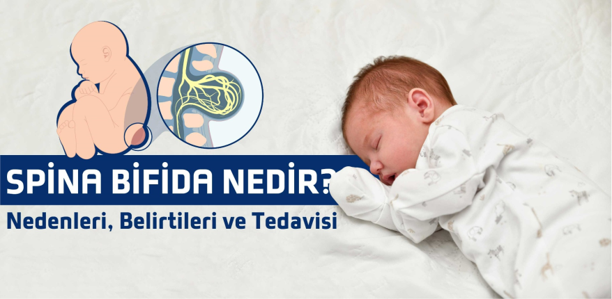 Spina Bifida Nedir? Nedenleri, Belirtileri ve Tedavisi