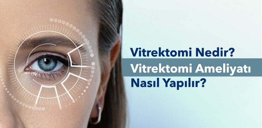 Vitrektomi Nedir? Vitrektomi Ameliyatı Nasıl Yapılır?