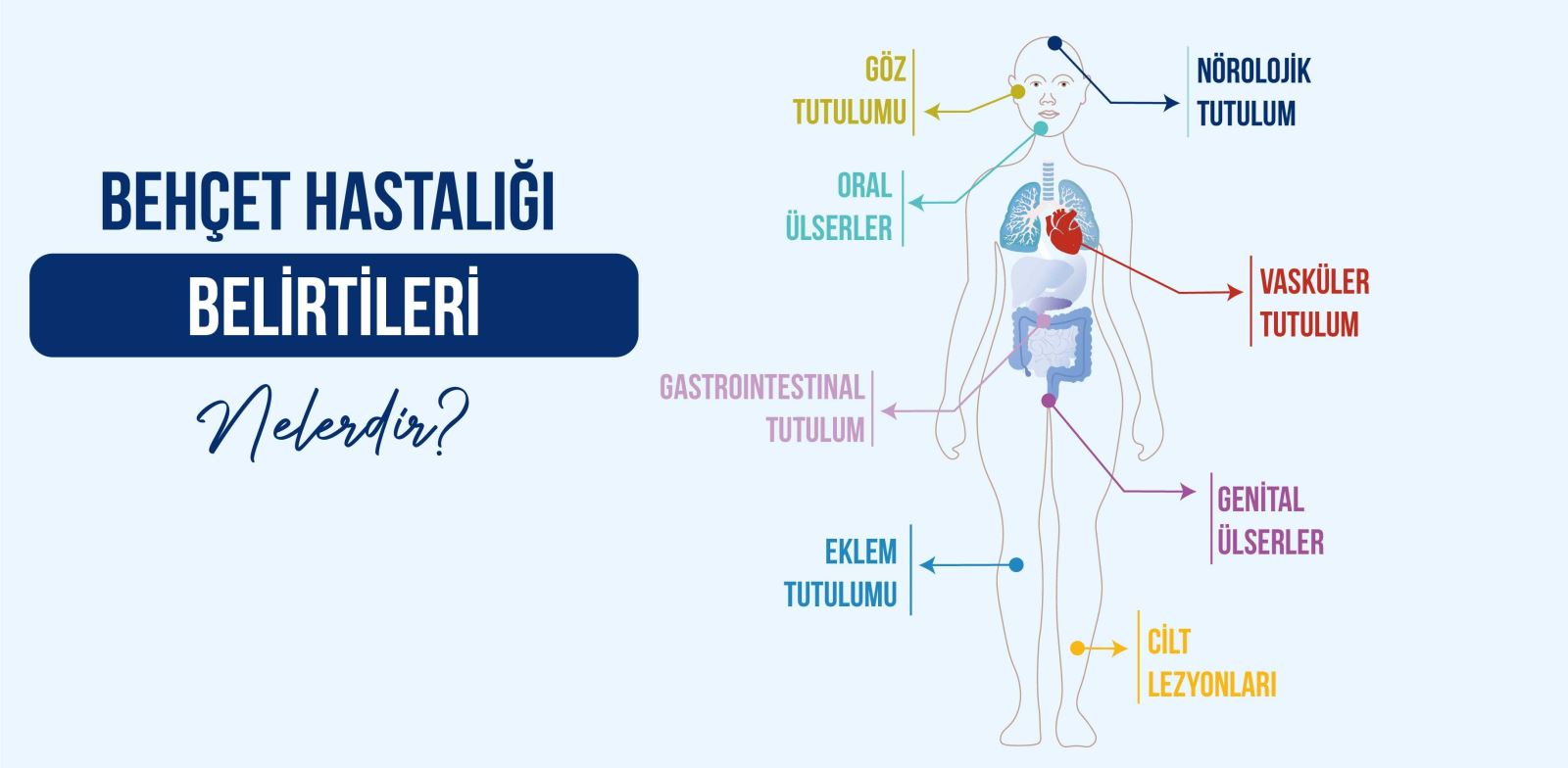 Behçet hastalığı belirtileri nelerdir?