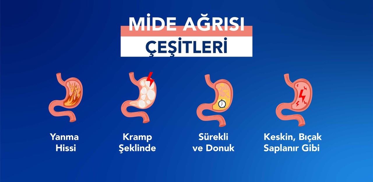 Farklı mide ağrısı türleri nelerdir? Kramp, yanma, keskin veya künt ağrı gibi mide ağrısı çeşitleri.